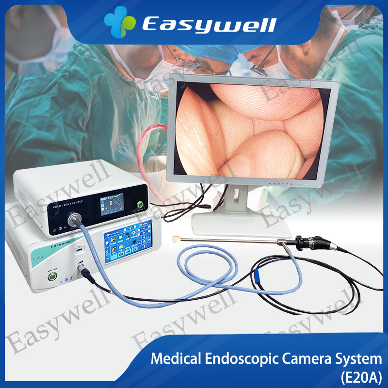 Electronic Endoscopy System