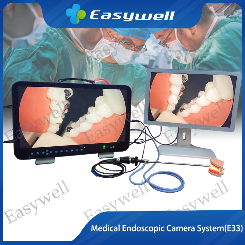 Medical Endosopic Camera Systems